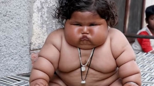 Hindistan’da 8 aylık bebek 17 kilo ağırlında
