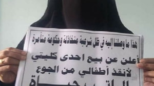 Yemenli kadın çocukları için böbreğini satışa çıkarttı
